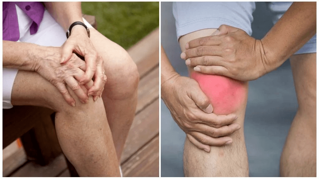 Trattamento dell'osteoartrite
