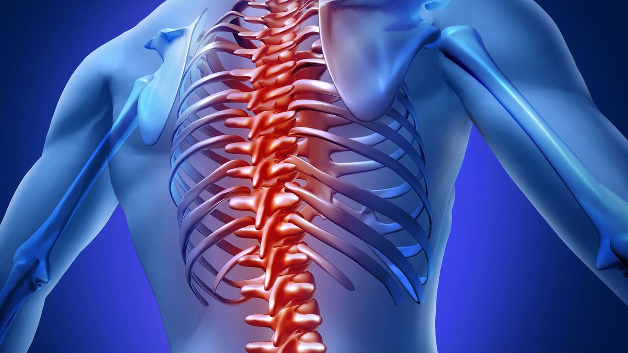 Osteocondosi toracica